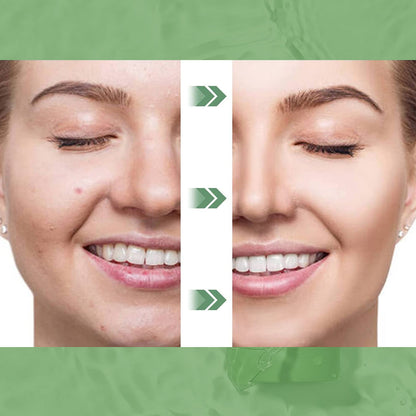 GreenMask™ - Máscara de chá verde (OFERTA LIMITADA 2 POR 1)